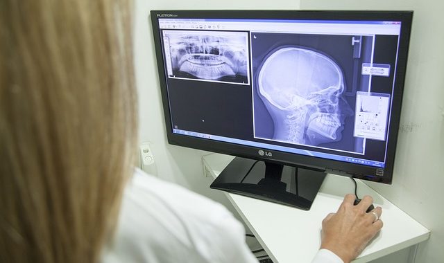 AI in x-ray: Don’t trust it yet